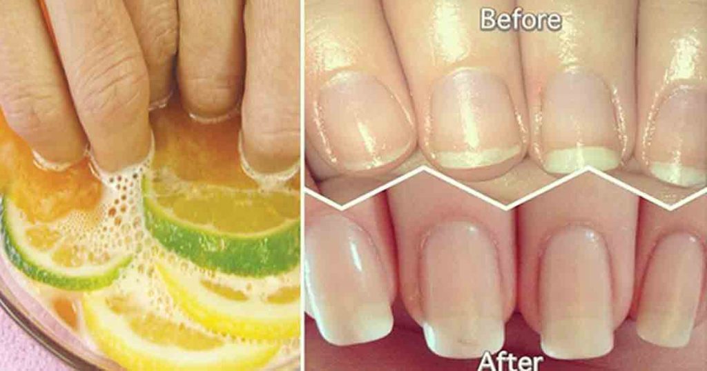7. DIY Coconut Oil Nail Soak for Stronger and Longer-Lasting Nails - wide 10